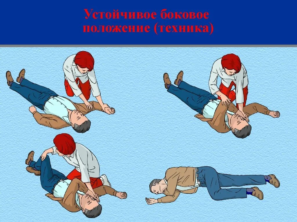 Боковое положение при травме. Слр устойчивое боковое положение. устойчивое боковое положение пострадавшего. стабильное боковое положение. устойчивое положение на боку пострадавшего.