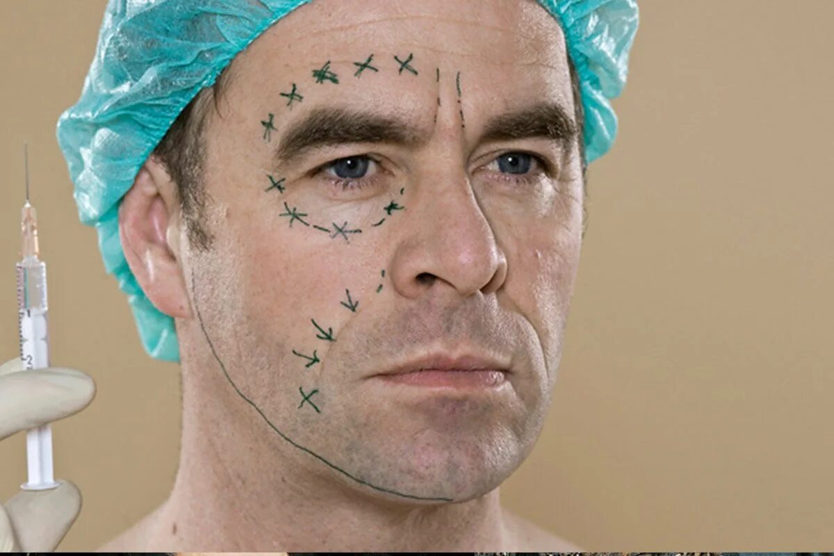 Кульчиев северьян. Консультация пластического хирурга. Пластичсекаяо перация. Хирург по лицу. Косметологическая операция.