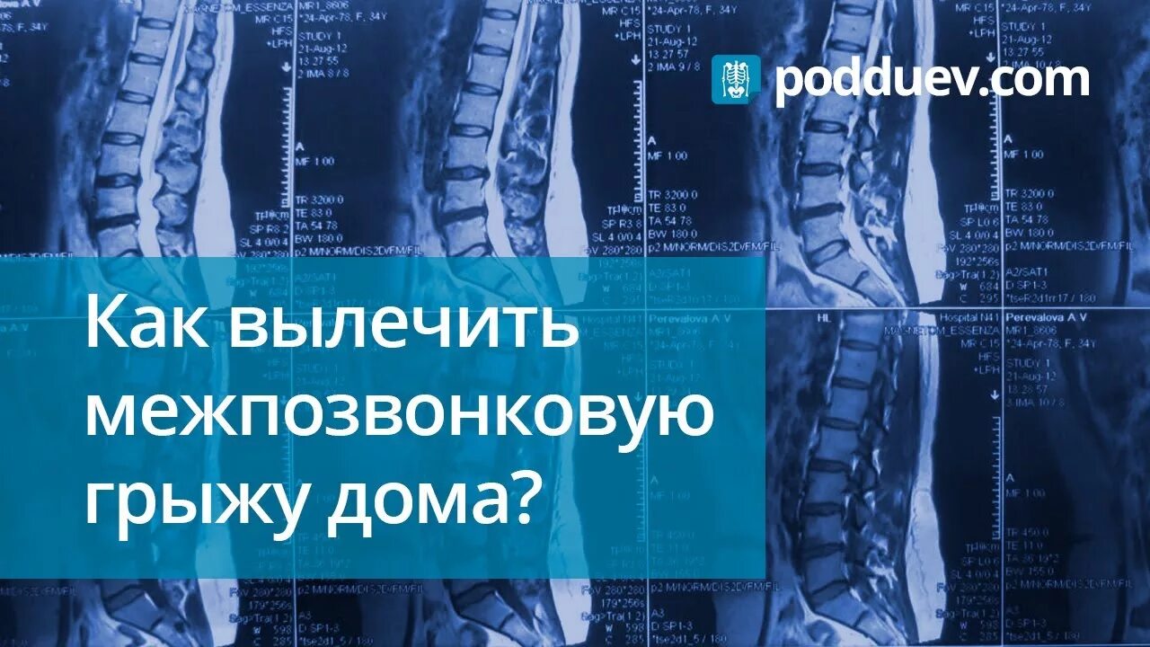 Можно ли греть грыжу поясничного. Грыжа позвоночника поясничного отдела. Межпозвонковая грыжа грудного отдела. Лекарство от межпозвоночной грыжи поясничного отдела позвоночника. Лекарство от межпозвонковой грыжи.