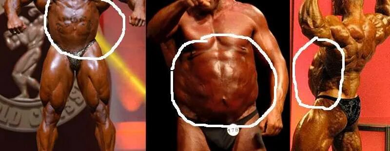 Анаболики стероиды. Колит стероиды. Колит стероиды. Анаболики стероиды. Анаболические стероиды (анаболики).