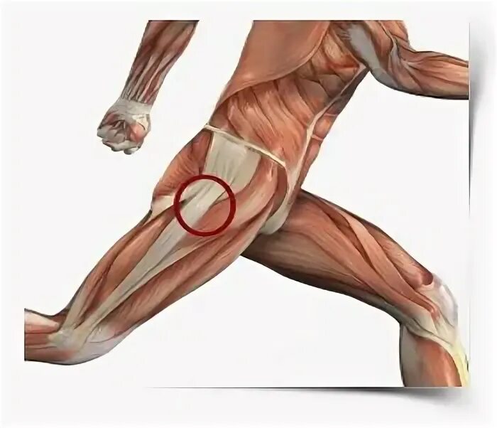 Кальцифицирующий тендинит тазобедренного сустава. Тендинит собственной связки надколенника. Тендиноз тазобедренного сустава что это такое. Бурсит трохантерит тазобедренного сустава. Тендинит сухожилия тазобедренного сустава.