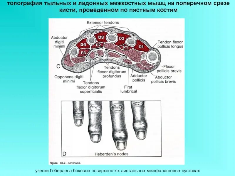 Фасциальные ложа кисти схема. Фасциальные ложа кисти схема. На ладони выделяют фасциальные ложа. Фасциальные ложа ладони. На ладони выделяют фасциальные ложа.