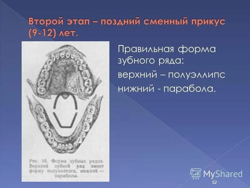 Форма зубной дуги верхней челюсти. Форма верхнего зубного ряда. Форма верхнего зубного ряда. Форма верхнего зубного ряда. Формы зубных дуг верхней и нижней челюсти.