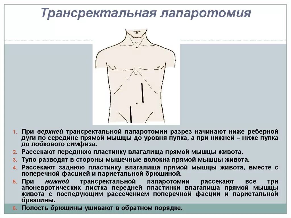 Лапаротомия что это такое простыми словами. Парамедианная трансректальная лапаротомия. Трансректальная левосторонняя послойная лапаротомия. Трансректальный разрез по Ленандеру. Срединно срединная лапаротомия.