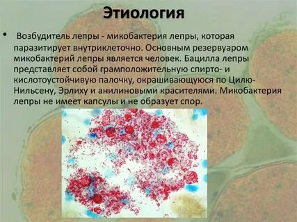 Возбудитель лиц