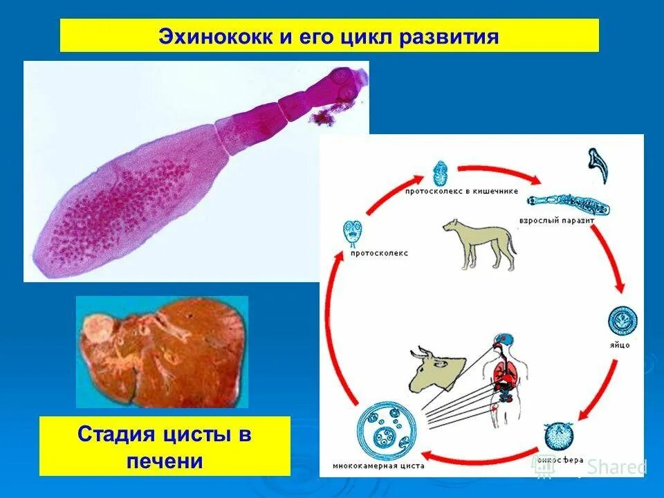 Эхинококк это плоские черви. Плоский червь эхинококк. Эхинококк приспособление к паразитическому образу жизни.