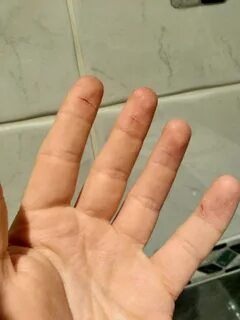 I ve cut my finger