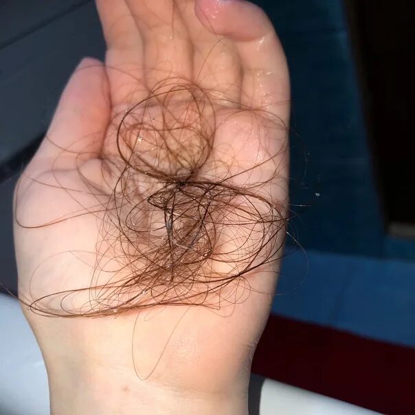 Выпадение волос при мытье