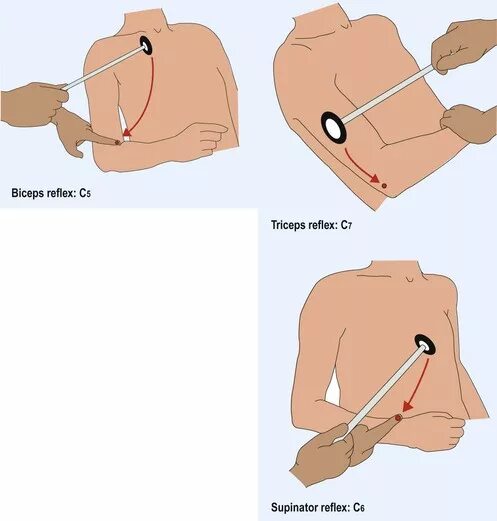 Рефлекс плеча. Рефлекс сухожилия двуглавой мышцы. Бицепс и трицепс рефлексы.