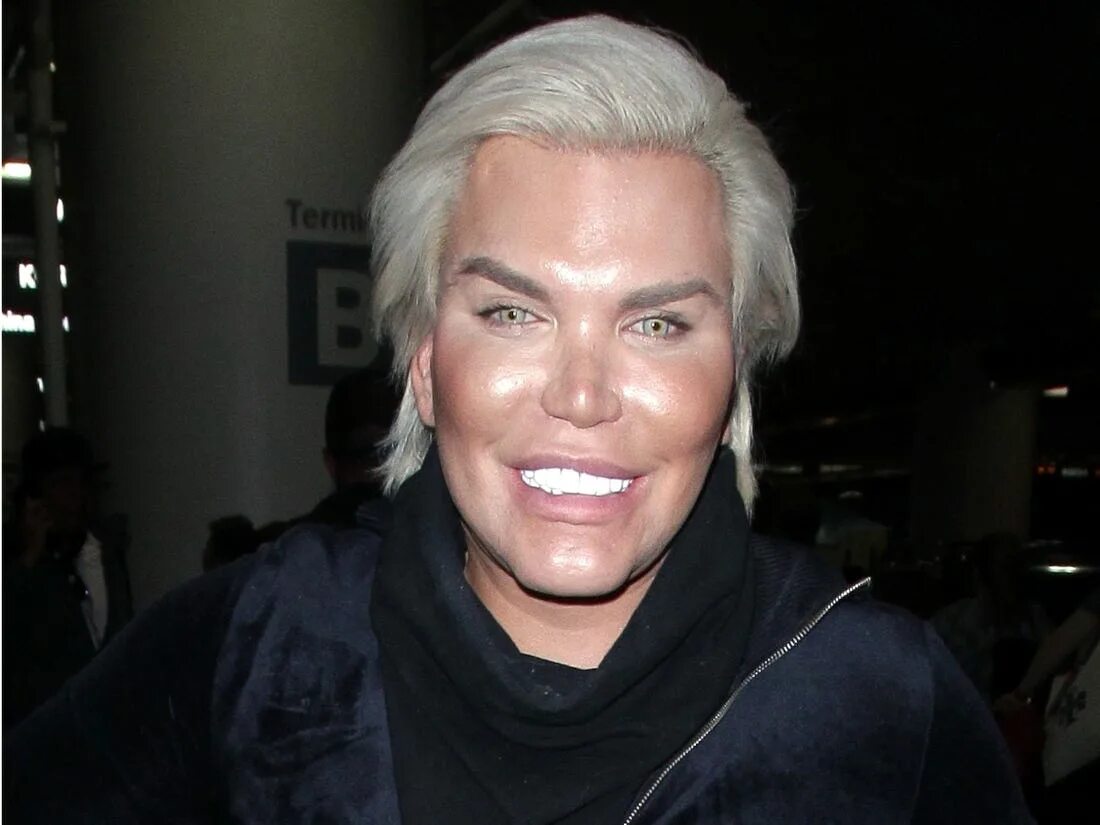 Много пластических операций. Джослин вильденштейн 2021. Джослин виндельштейн 1970. Много пластических операций. Джослин вильденштейн 2018.