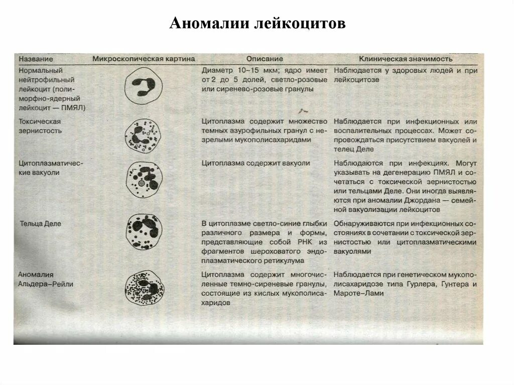 Патология лейкоцитов. Наследственные аномалии лейкоцитов. Пельгеровская аномалия лейкоцитов. Патология в цитоплазме лейкоцитов.