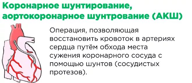 Реабилитация пациентов после операции аортокоронарное шунтирование. Операция коронарное шунтирование сосудов сердца. Шунтирование артерий сердца. Как делают коронарное шунтирование