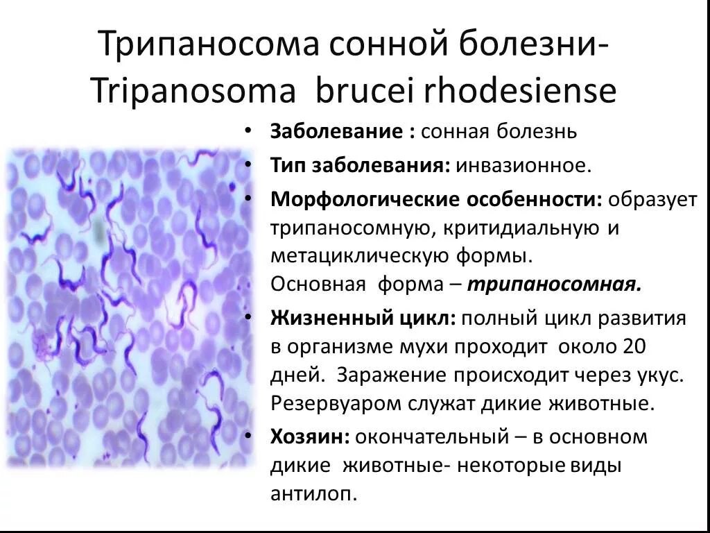 Сонная болезнь укус цеце. Сонная болезнь признаки. Паразитические простейшие сонная болезнь. Муха цеце переносчик сонной болезни. Сонная болезнь симптомы.