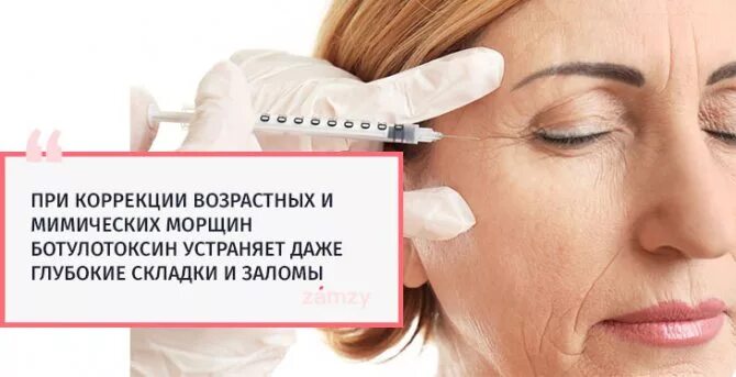 Ботулотоксин плюсы. Ботулотоксин препараты. Контурная пластика. Ботулотоксин аллерган. 4.