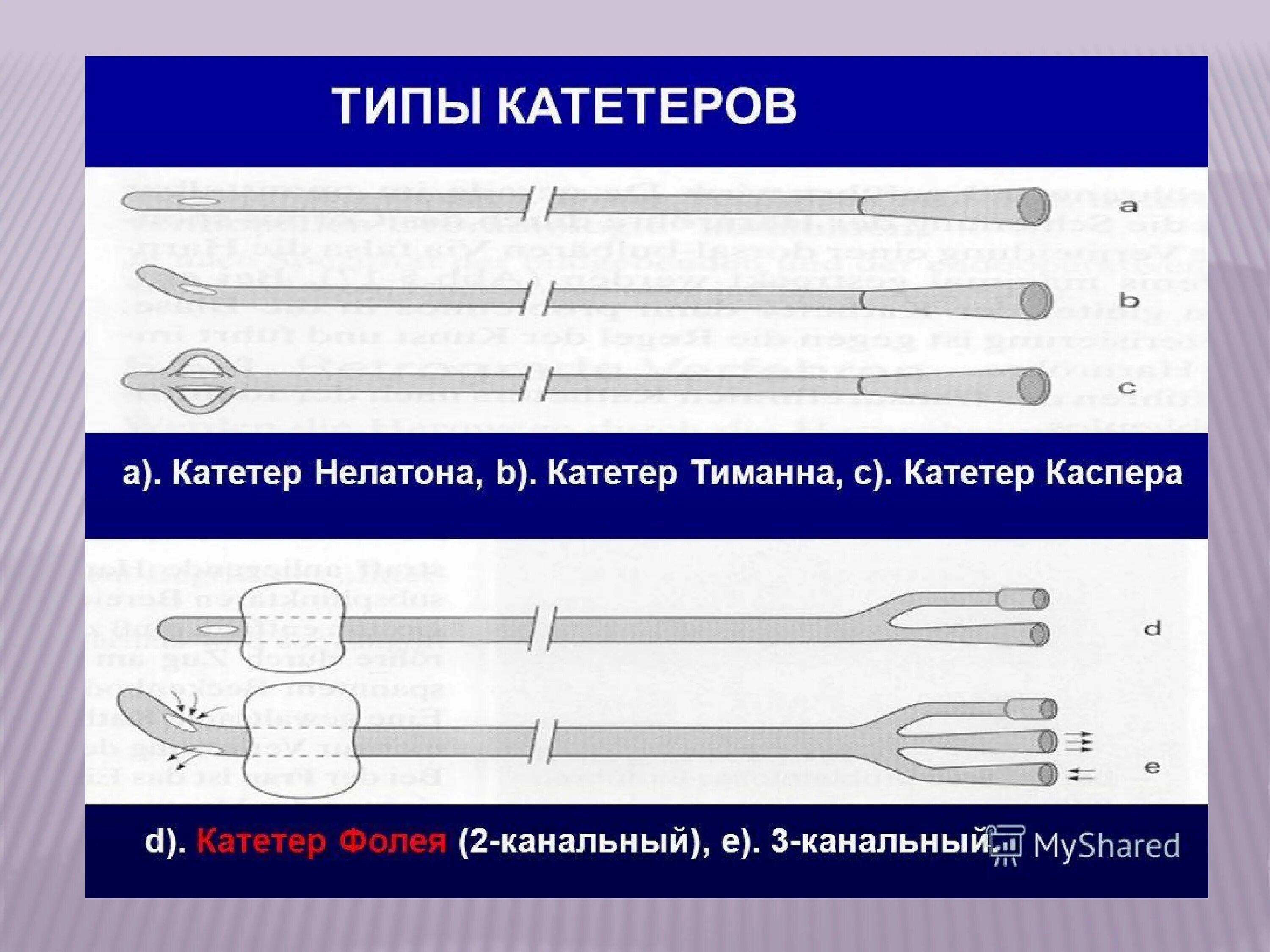 Чем отличается катетер. Катетер Нелатона катетер Тиманна катетер Фолея. : Катетер катетеры Тимана. Тип Тимана катетер Фолея. Урологический катетер Тиманна.