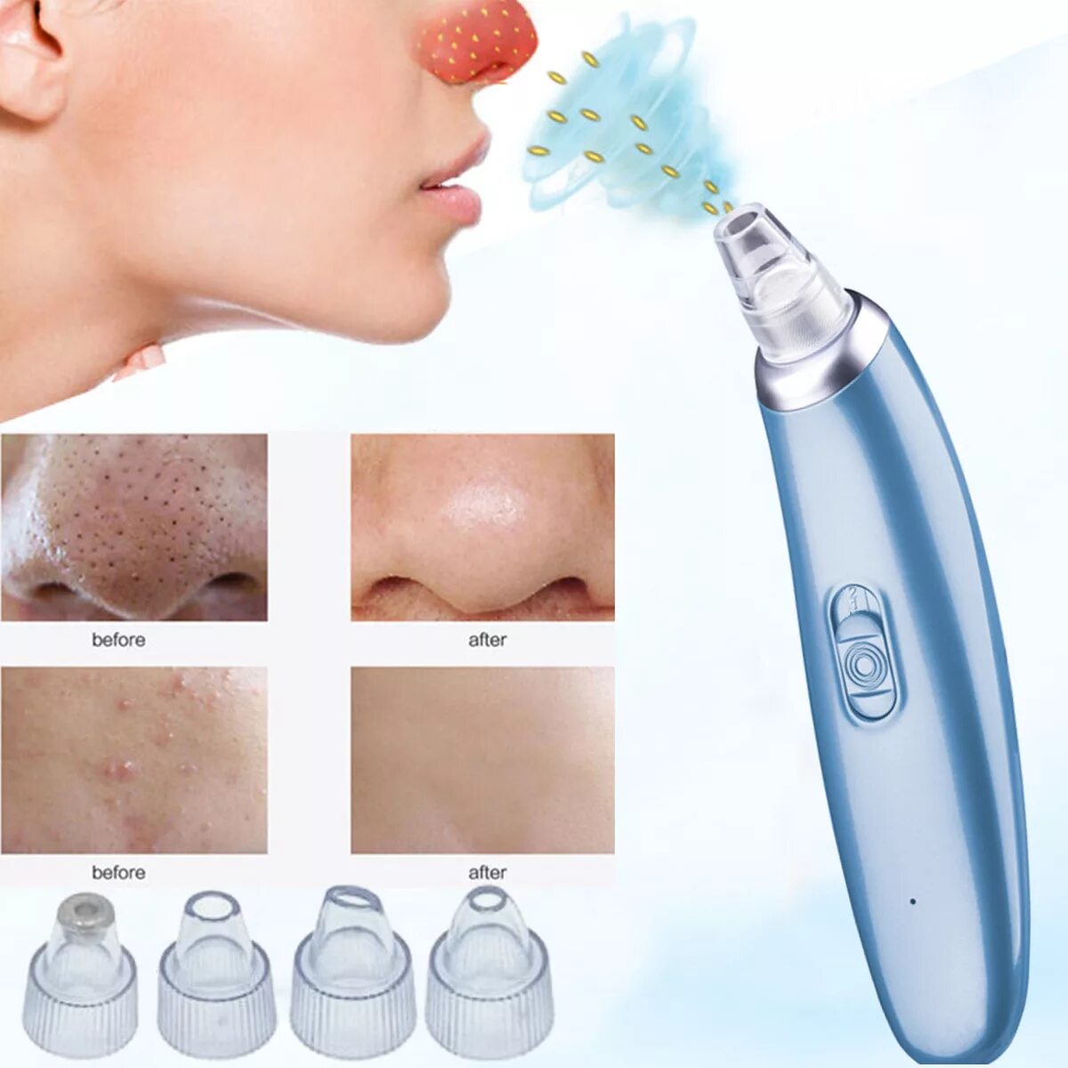 Аппарат для чистки черных точек. Избавление от чёрных точек. Blackhead remover mask clean pores deeply. Прибор для вакуумной чистки угрей. Маска для очистки пор носа.
