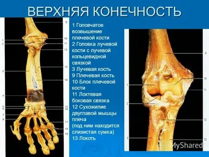 Головчатая кость