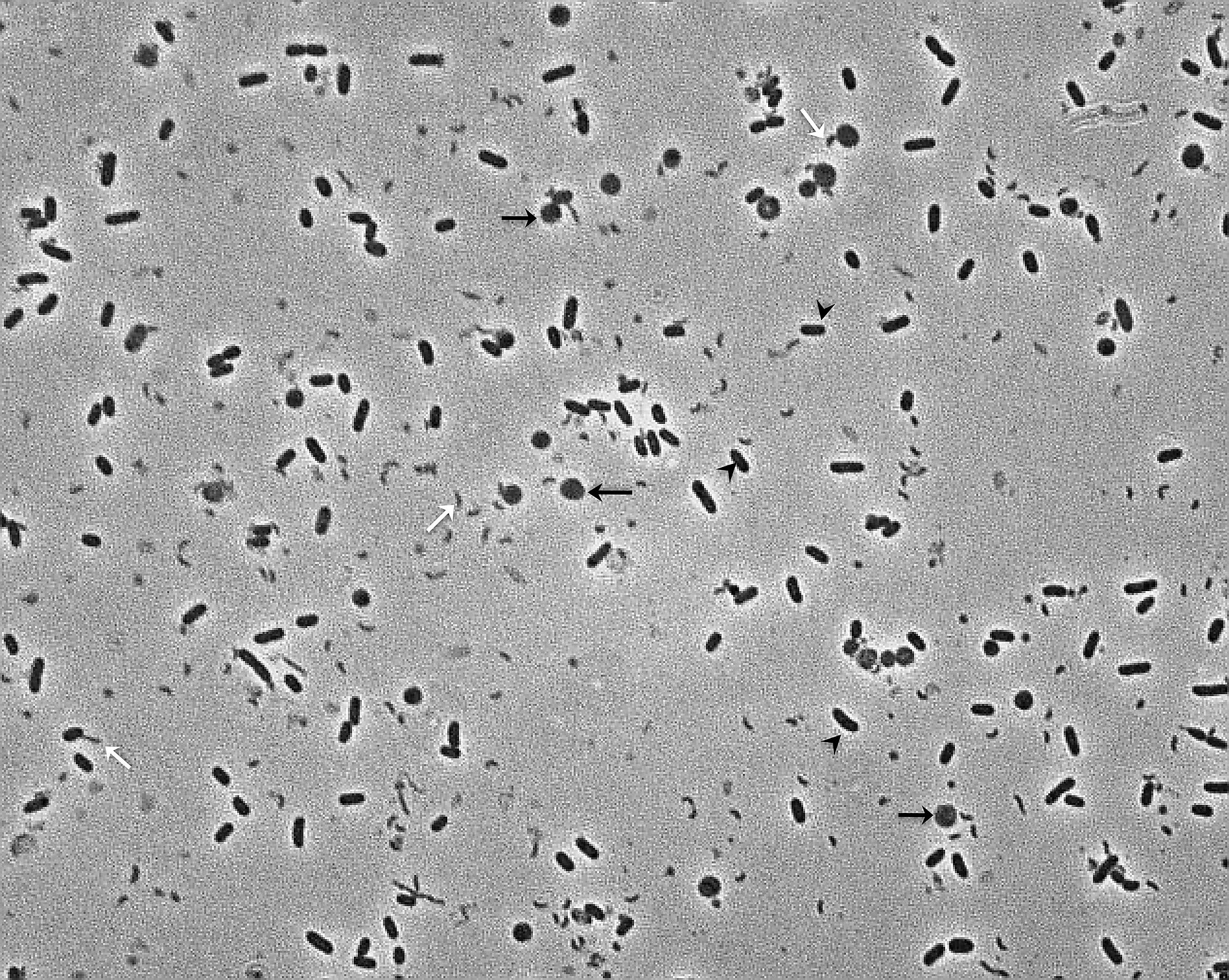 Bdellovibrio bacteriovorus. Pyrolobus fumarii. Сульфатредуцирующие бактерии под микроскопом.