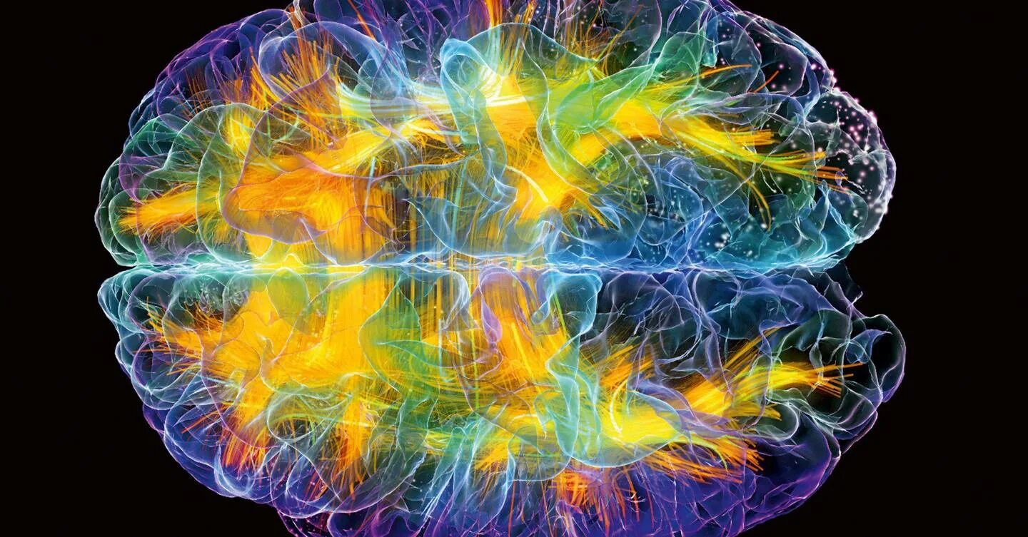 12 brains. Визуализация мозга. Активность мозга. Гибридная визуализация мозга.