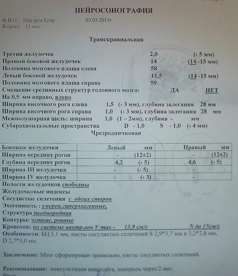 Мозг новорожденного норма. УЗИ головного мозга 1 месяц показатели норма. Нейросонография показатели нормы. Нейросонография протокол УЗИ.