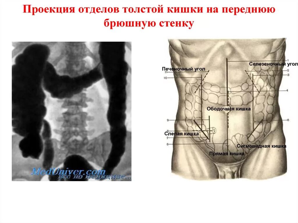 Области живота и проекция сигмовидной кишки. Область проекции слепой кишки на брюшную. Область проекции сигмовидной кишки на брюшную стенку. Нисходящая ободочная кишка голотопия. Толстая брюшная стенка