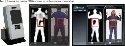 Rare scanner