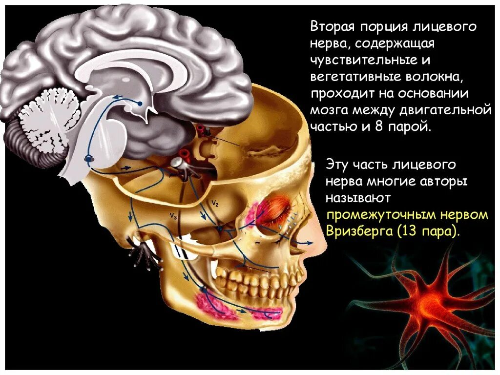 7 черепной нерв. VII пара лицевой нерв иннервирует. Лицевой нерв на основании мозга. Седьмой черепно мозговой нерв. Черепно лицевые нервы.