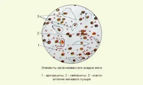 Лейкоциты и эритроциты в моче при беременности