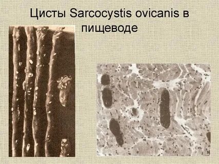 Саркоцисты
