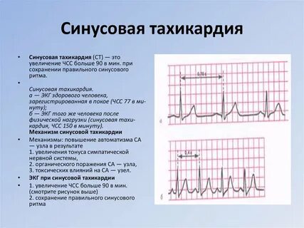 Где возникают импульсы вызывающие ритмические сокращения сердца
