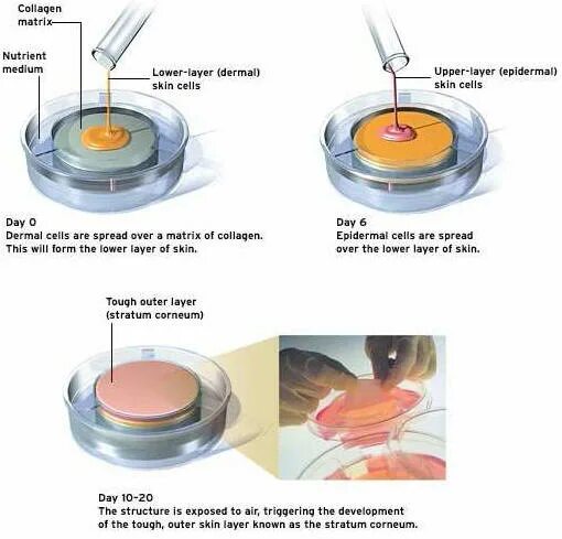 Культура клеток крови. Искусственная кожа для трансплантации. Дермальный эквивалент кожи. Эквивалент кожи. Применение культивированных аллофибробластов.