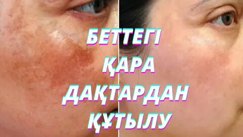 Жалаңаш Вилла сиқыршысы