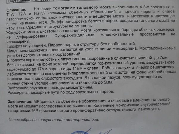 Мрт при сотрясении. Кт головного мозга заключение норма. Компьютерная томография головного мозга норма. Кт головного мозга описание норма. Компьютерная томография головного мозга заключение норма.