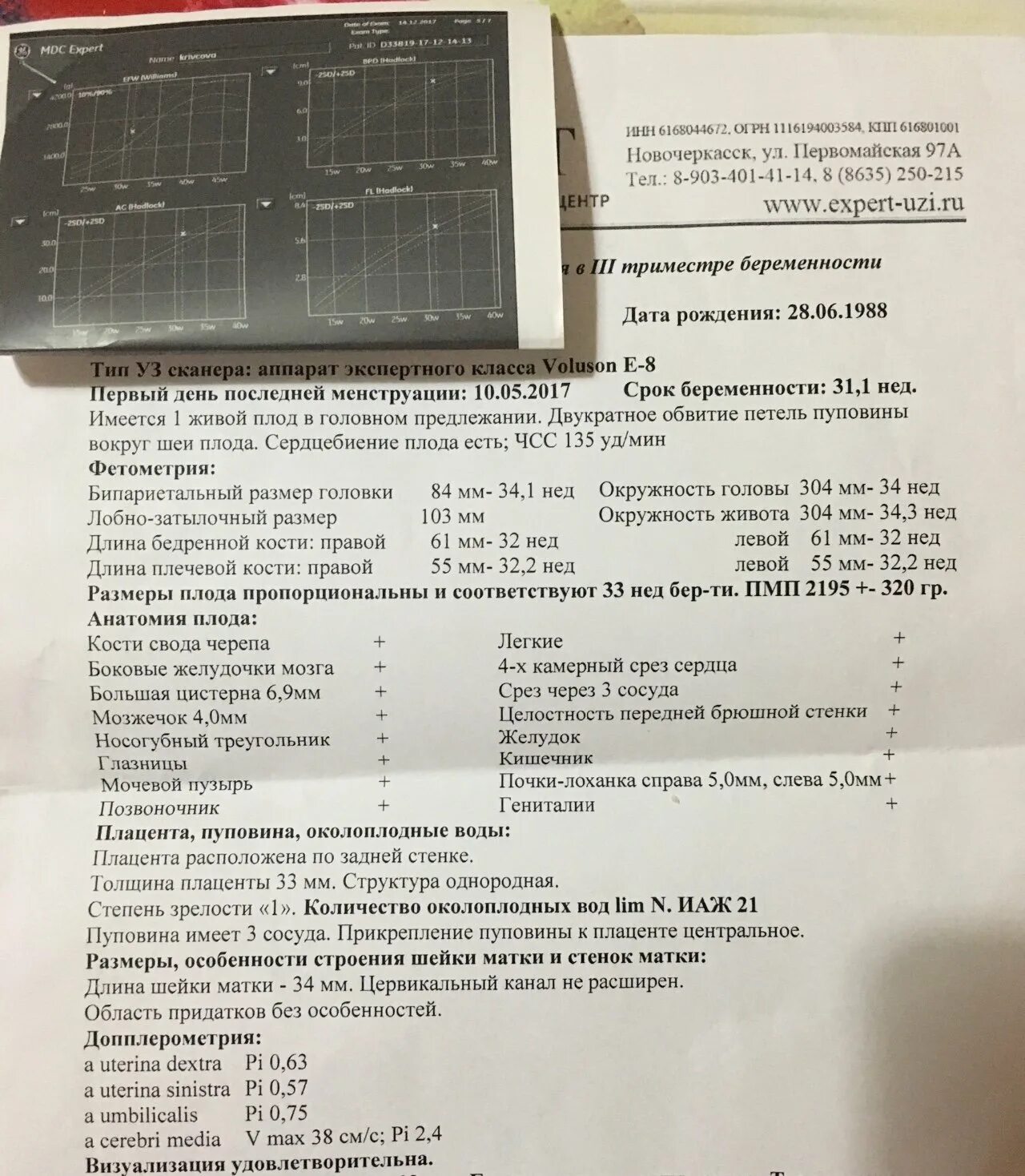 Фетометрия на 32 неделе беременности норма. БПР В 12 недель беременности. Фетометрия на 33 неделе беременности. Фетометрия плода по неделям таблица норма 33 недели.