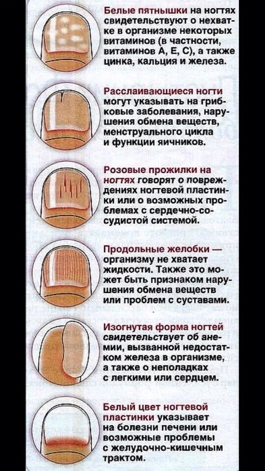 Как узнать болезни по ногтям. Заболевания ногтей на руках таблица. Диагностика по ногтям. Определить заболевание по ногтям. Определить заболевание по ногтям.