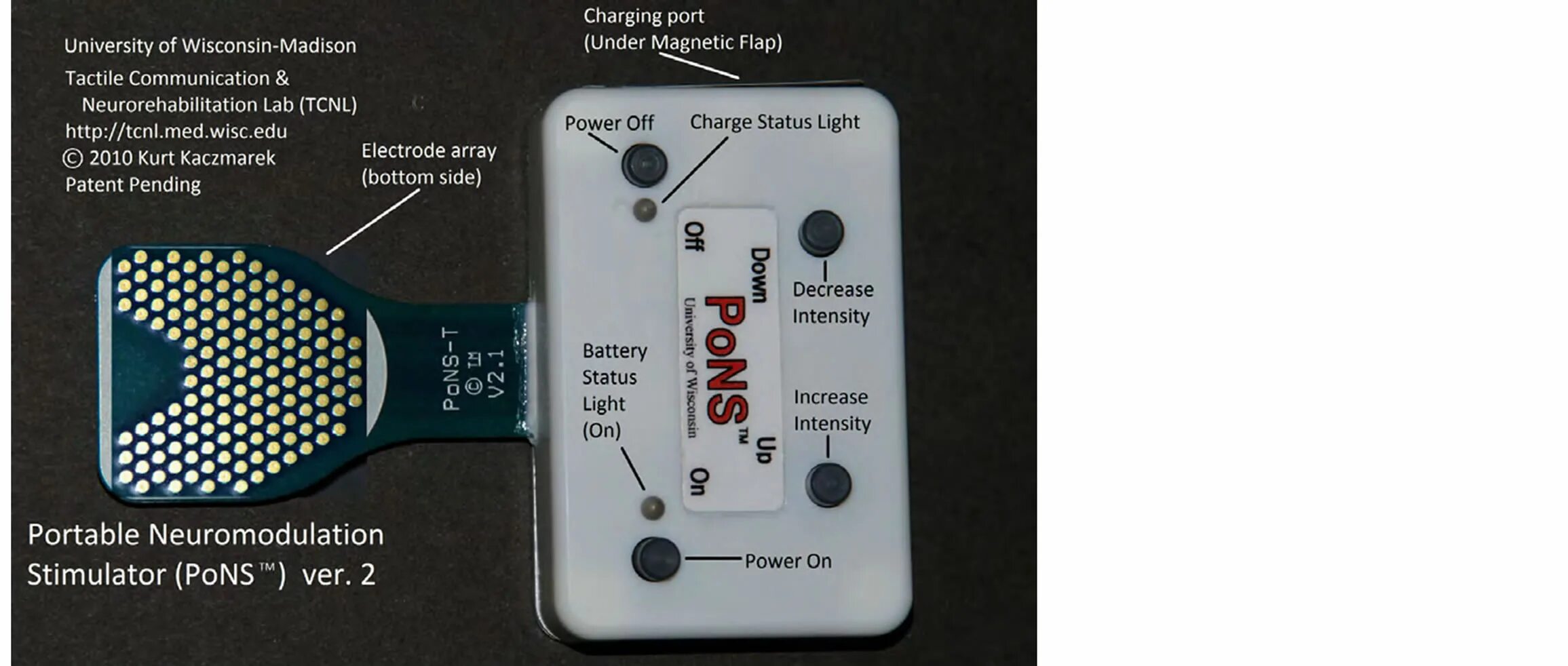 Портативного нейромодулирующего стимулятора Pons. Аппарат Нейропорт. Portable Neuromodulation Stimulator, Pons купить. Neuromodu lation device.