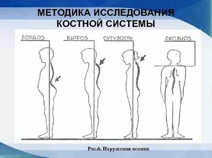Состояние костной системы