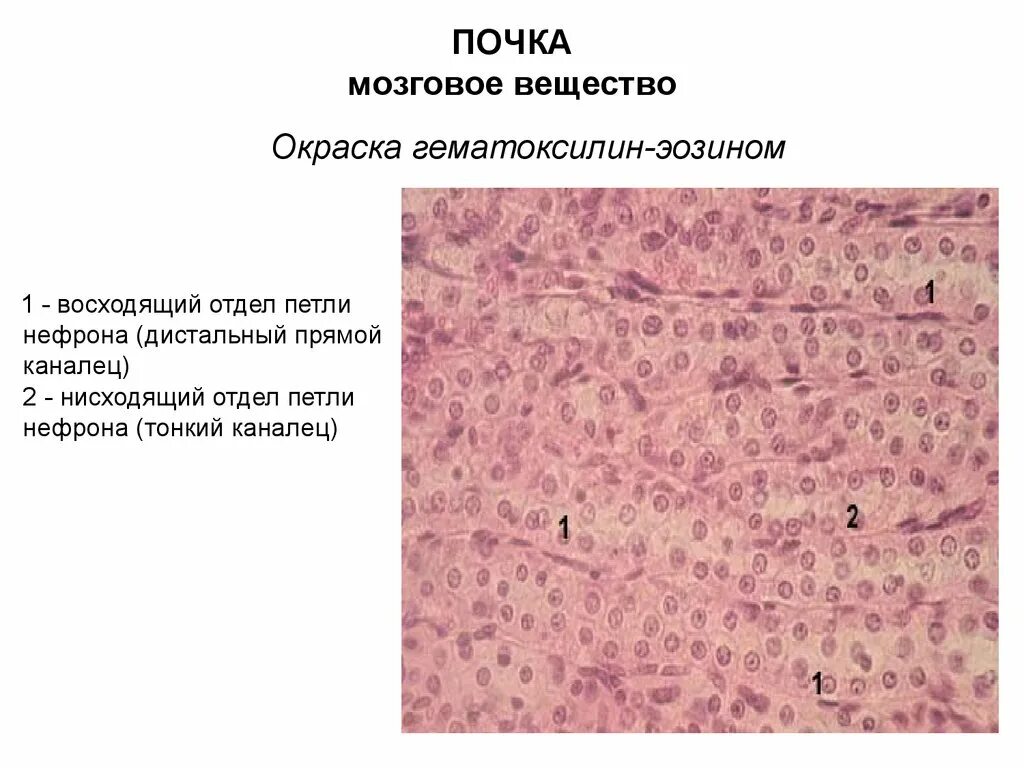 Почка человека препарат. Почка окраска гематоксилин-эозином. почка крысы окраска гематоксилином и эозином. окрашивание гематоксилин-эозином в гистологии. мозговое вещество почки гистологический препарат.