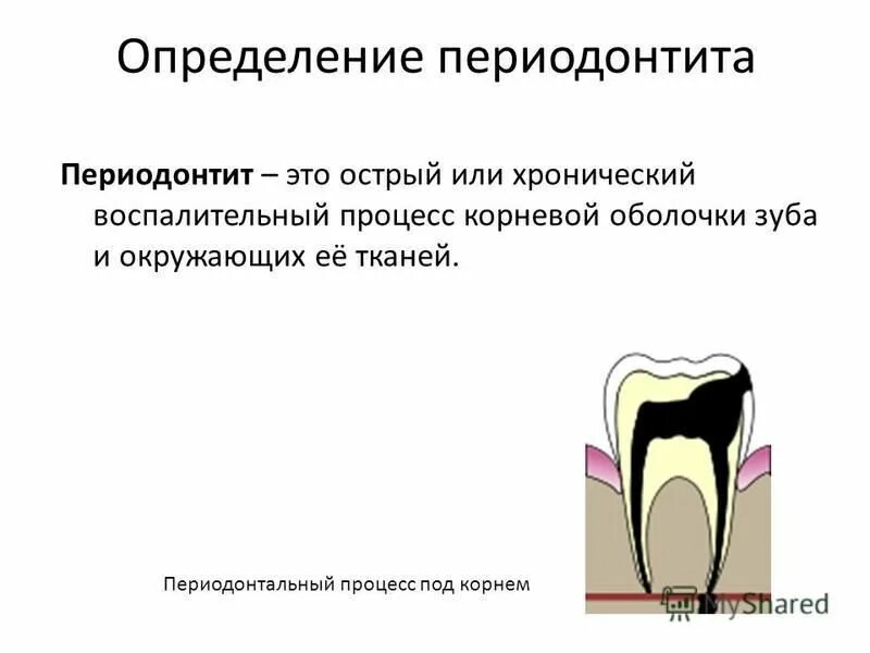 Апикальный периодонтит зуба 2.4. Причины развития хронического периодонтита. Осложнение лечения периодонтита