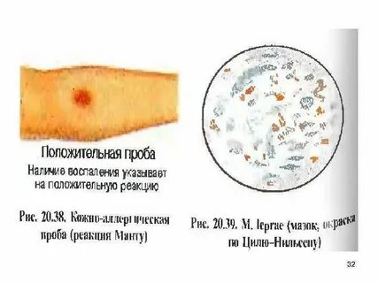 Микобактерии туберкулеза относятся