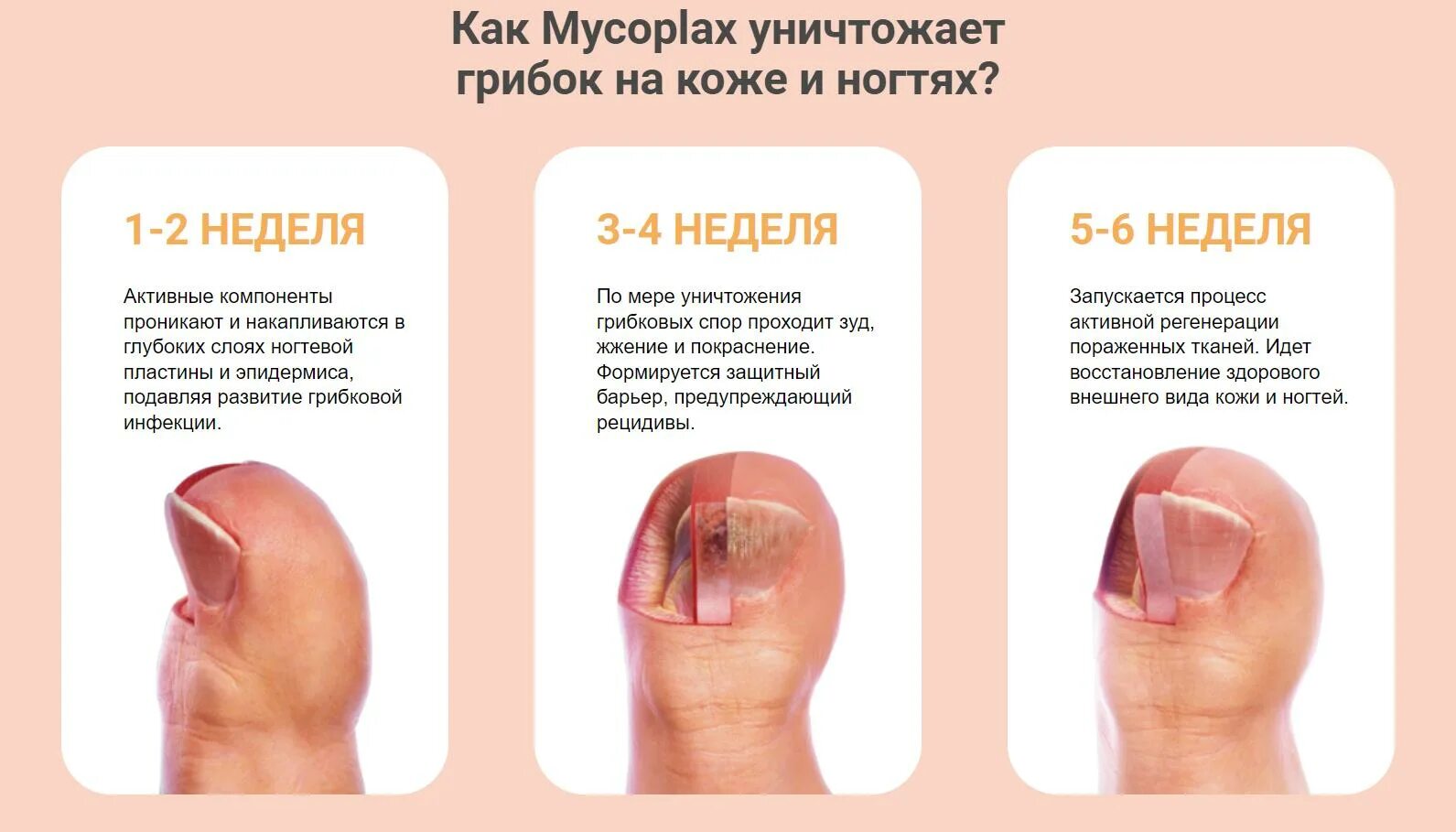 Анализ на грибы с кожи соскоб. Анализ на грибы ногтей. Микроскопическое исследование ногтевых пластинок. Исследование соскоба кожи на грибы. Исследование на грибок кожи.