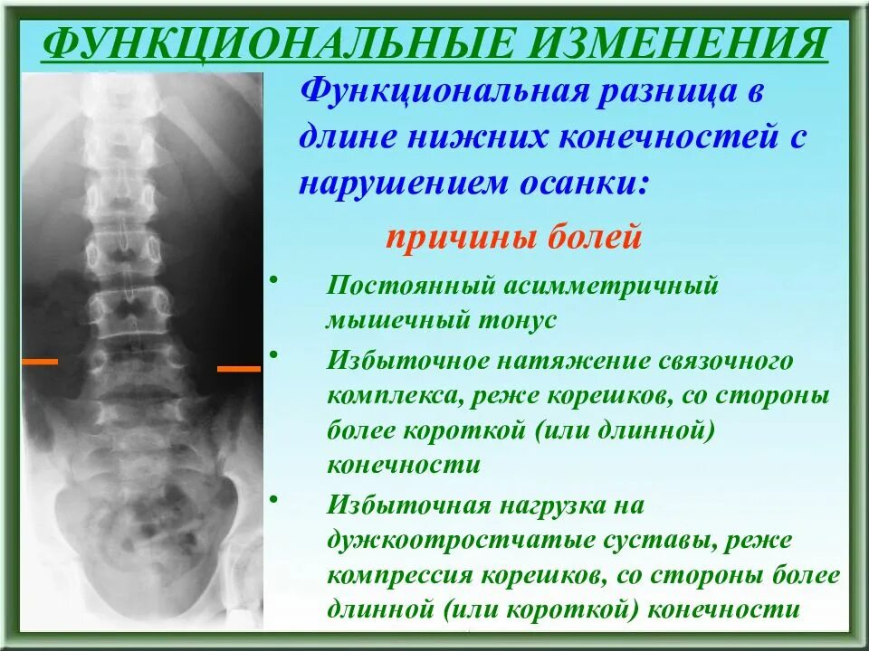 Стойкие функциональные изменения