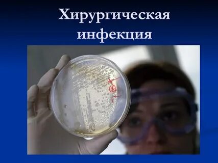 Инфекции общая хирургия