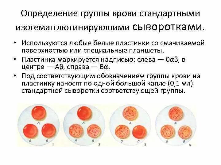 Как отличить кровь. Сывороточный метод определения группы крови. Конечный результат при определении группы крови. Выявление группы крови гемагглютинируюшими сыворатка. Методика определения группы крови стандартными сыворотками.