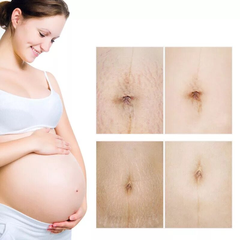 лицо беременной женщины. беременность. акне беременных. гигиена беременной женщины. гормональный фон беременной женщины.