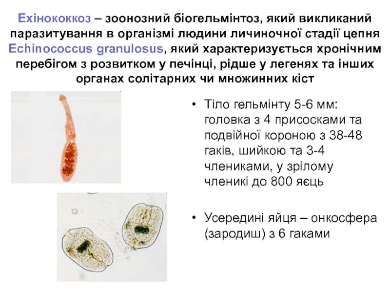 Эхинококк промежуточный хозяин. Эхинококкоз инфекционные болезни. Эхинококкоз биогельминт. Эхинококкоз печени этиология.