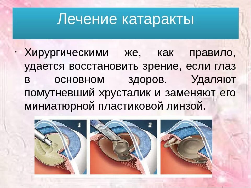 Катаракты без лечения