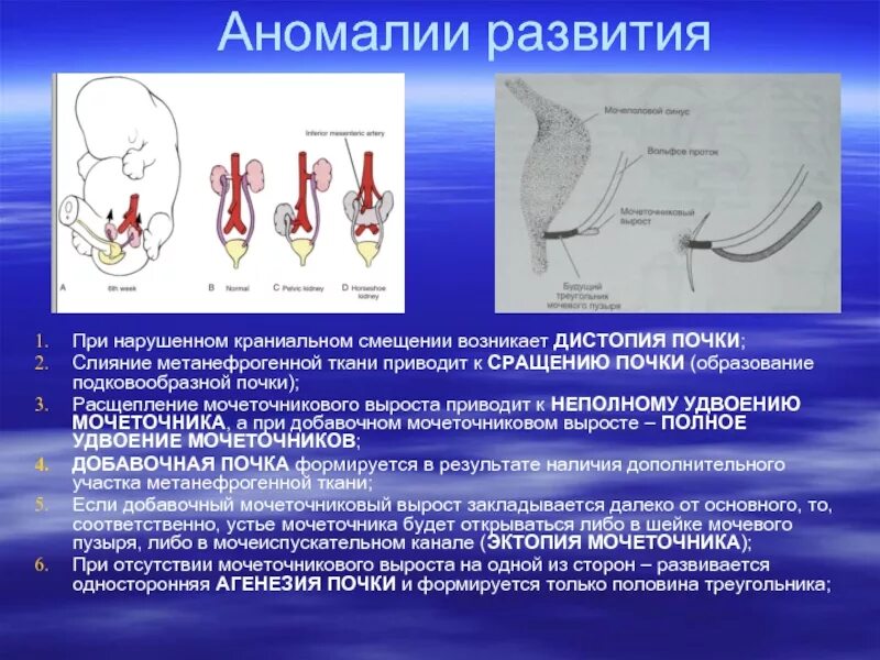 Развитие мочеточников. Врожденные пороки развития органов мочеполовой системы. Пороки развития мочевого пузыря. Пороки развития органов мочевыделительной системы. Развитие и аномалии развития органов мочевыделительной системы.