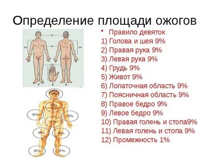 Что можно определить с помощью правила девяток