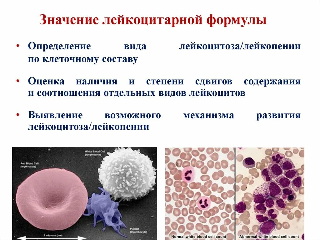 Реактивные изменения лейкоцитов. Лейкоциты фагоциты лейкоцитарная формула. Формула ядерного сдвига лейкоцитарной формулы. Значение лейкоцитарной формулы. Лейкоцитарная формула функции лейкоцитов таблица.